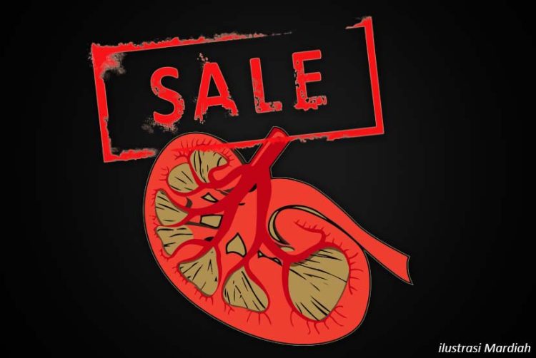 Jual Ginjal (ilustrasi). (Mardiah/Republika)